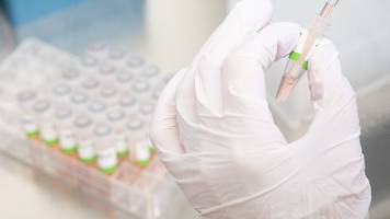 Corona-Welle: Labore stoßen bei PCR-Tests an Kapazitätsgrenzen