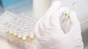 PCR-Tests: Schiefe Vergleiche und falsche Aussagen
