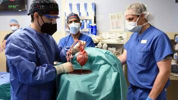 laut us-chirurgen - mann starb nach schweinherz-transplantation - organ war wohl virusverseucht