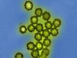 Saisonales Grippevirus stammt möglicherweise von Spanischer Grippe ab