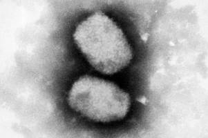 Virus: Was sind Affenpocken? Und was kann man gegen sie tun?