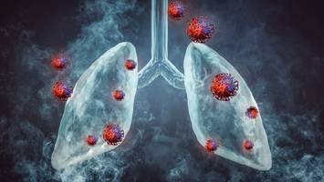 Lunge wieder im Visier - Wissenschaftler fürchten: Omikron-Subtypen ähneln mehr der „tödlicheren“ Delta-Variante