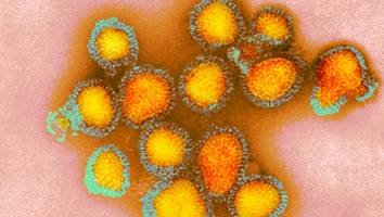 auf menschen übertragbar - schwerste vogelgrippe-epidemie aller zeiten - was sie wissen müssen