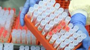 Hinweise auf mögliche Milliardenverschwendung bei PCR-Tests