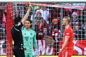 Leverkusen-Spiel als Gefahr: Nagelsmann hat Vertrauen