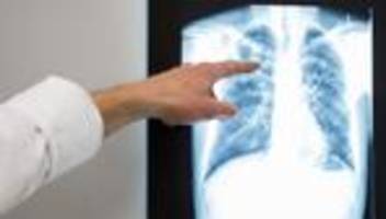 gesundheit: etwas mehr tuberkuloseerkrankungen 2022 in bayern
