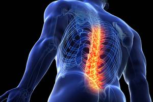 Neue „Lancet“-Studie - Häufigste Ursache für Arbeitsausfälle - was gegen Rückenschmerzen hilft