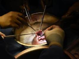 Transplantation gut überstanden: Weltweit zweiter Patient erhält Schweineherz