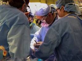 Meilenstein für Schwerkranke: Ärzte transplantieren erstmals Schweineniere