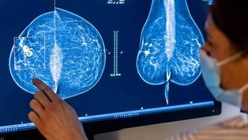 frauen können zur brustkrebs-früherkennung daten hinterlegen