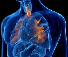 stille epidemie der atemwege - nicht nur rauchen, auch ernährung und klimawandel schaden unserer lunge