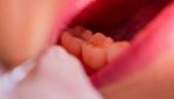 Türkei: Zahnarzt bohrt versehentlich Schraube in Gehirn von Patient