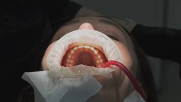 Horrorszenario - Zahnarzt rammt Mann Schraube ins Gehirn, nennt es medizinische Komplikation