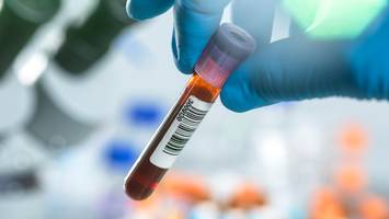 durchbruch in der medizin - forscher verwandeln blutgruppen a und b in universalblut