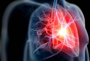 Erhöht Risiko für Infarkt und Schlaganfall - Schon ein paar Minuten Wut am Tag schädigen unser Herz