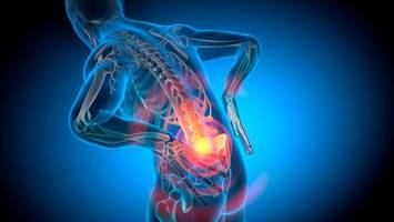 Physiotherapeuten erklären, was gegen Rückenschmerzen hilft