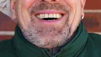 Forscherin: Lachen könnte sinnvoller Therapieansatz sein