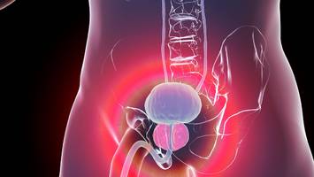 weltweite zunahme um 85 prozent bis 2040 - immer mehr todesfälle durch prostatakrebs – welche symptome es gibt