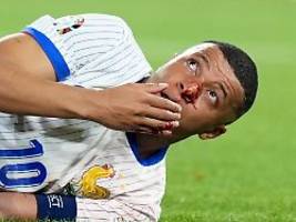 superstar ab jetzt wohl maskiert: blutiger crash: mbappé scherzt, frankreich bangt