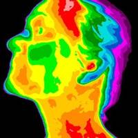 Neue Technologie: Reicht beim Arzt bald ein Gesichtsscan?