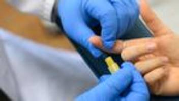 robert koch-institut: 2.200 menschen sollen sich 2023 in deutschland mit hiv infiziert haben