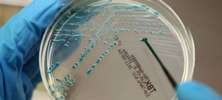 bei lidl und kaufland gibt es rückrufe bei wurst- und fischprodukten