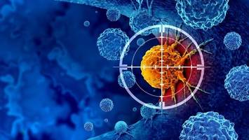Krebs: Neuer Test hilft bei der Suche nach bester Therapie
