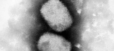 was sind affenpocken? infos rund um symptome, Übertragung und quarantäne