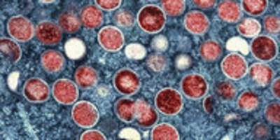 „mpox“-virus in berlin: impfen mit hürden