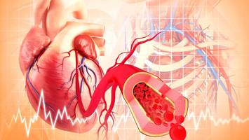 Weltherztag - Warum viele Männer ihr Herz leiden lassen - und wie sie es schützen können
