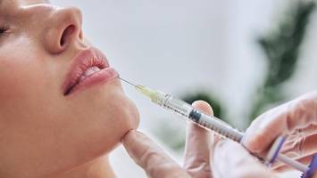 kundinnen lippen unterspritzt – obwohl kosmetikerin es nicht durfte