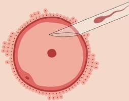 Reproduktionsmedizin: Müsste das nicht eigentlich viel besser gehen?