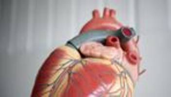 organspende: positive einstellung zu organspende steigt leicht
