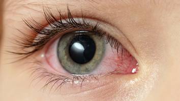 vor allem im winter - harvard-forscher raten: mit der 20-20-20-regel schützen sie ihre augen