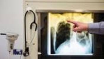 infektionen: köpping: tuberkulose-prävention weiter sehr wichtig