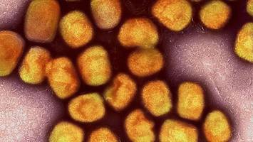 immer mehr mpox-fälle in berlin – droht ein größerer ausbruch?