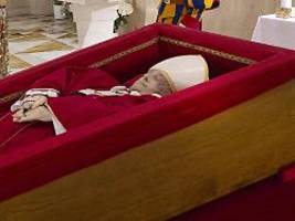 Ärzte erklären Ursache: Warum hat der Papst einen dunklen Fleck im Gesicht?