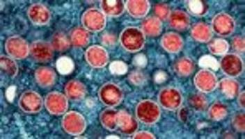 mpox-infektion: mpox-infektion bei mann in nordwestmecklenburg nachgewiesen