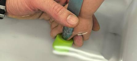Feuerwehr befreit Bub mit Säge von Plastikring