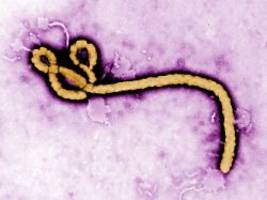 Einsatzkräfte müssen ausrücken: Mann in Tschechien könnte mit Ebola infiziert sein