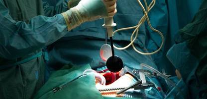 krankenkassen drängen wegen finanzmisere auf kosten-notbremse