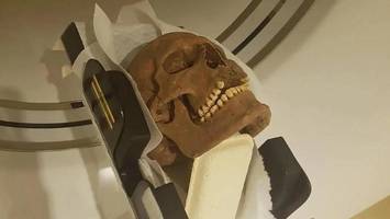 schweden: ct-scans enthüllen die versteckten leiden der wikinger