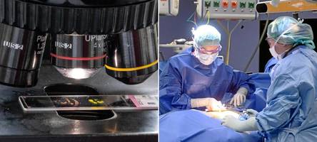 Krebs auf dem Vormarsch: Warum die Lage in Augsburg besonders ist