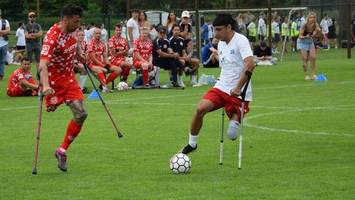 darum spielen alle fußballer mit krücken auf dem platz