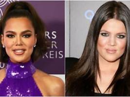 schonungslos ehrlich: khloé kardashian listet alle ihre beauty-eingriffe auf