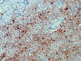 Übertragungswege bleiben unklar: Zweiter Patient mit Borna-Virus-Infektion stirbt