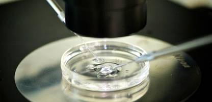 Fortpflanzungsbiologie: Spermien aus dem Labor nicht mehr weit entfernt
