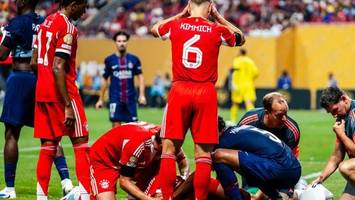 FC Bayern nach Musiala-Verletzung zwischen Schock und Wut