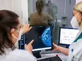 Im Kampf gegen Brustkrebs: Mammografie-Screening wirkt - ist aber verbesserungswürdig