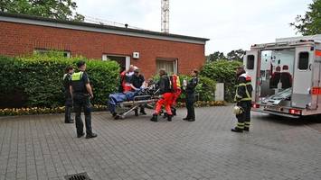 mann zündet zigarette an und verbrennt sich schwer im gesicht